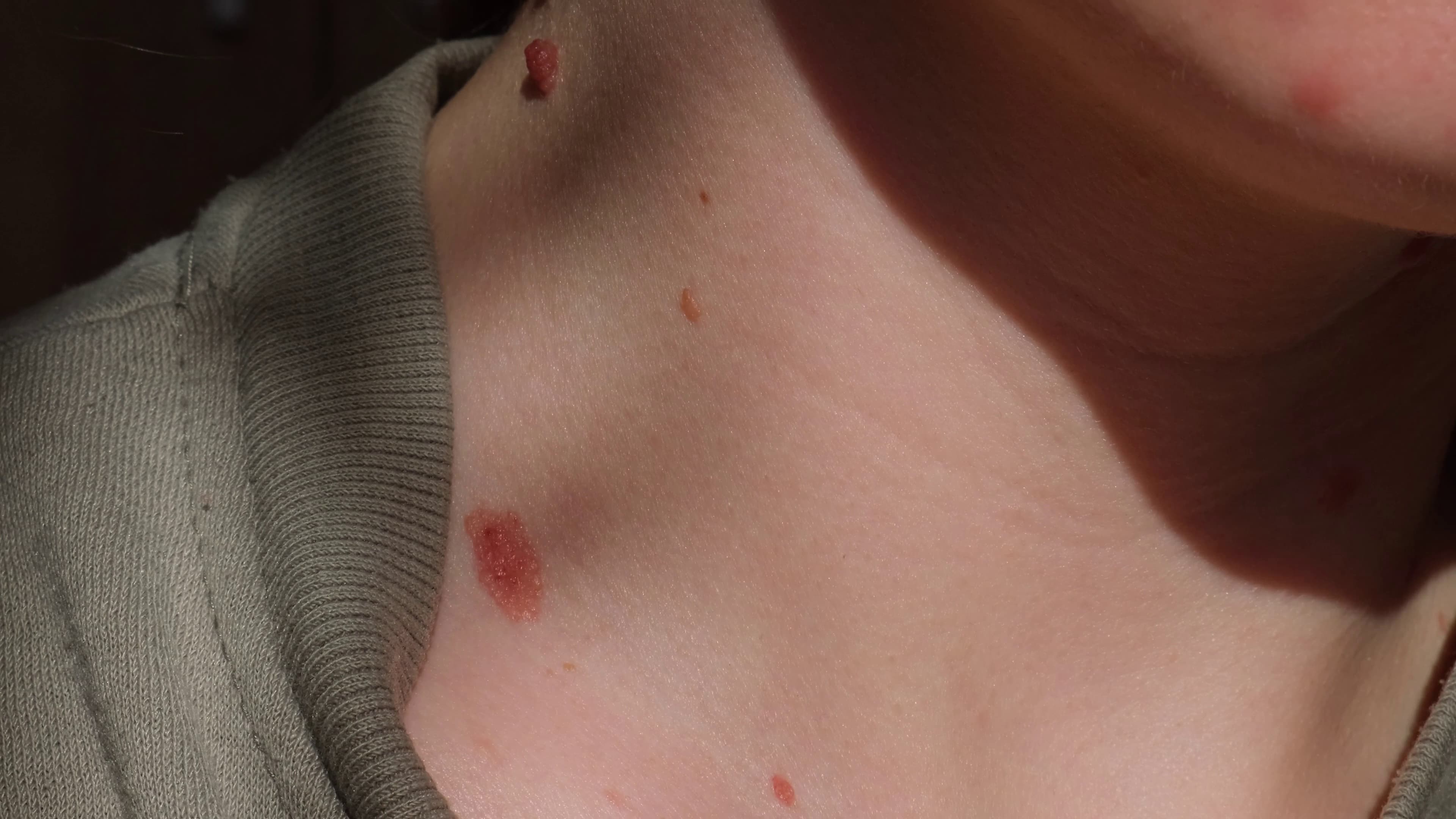 Dermatology & Immunology